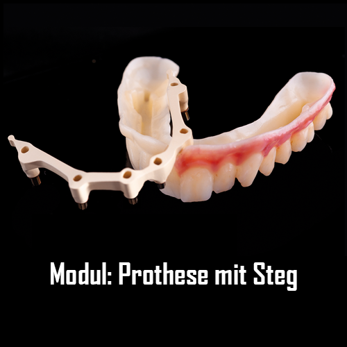 UNIQUE CAM Prothese auf Steg